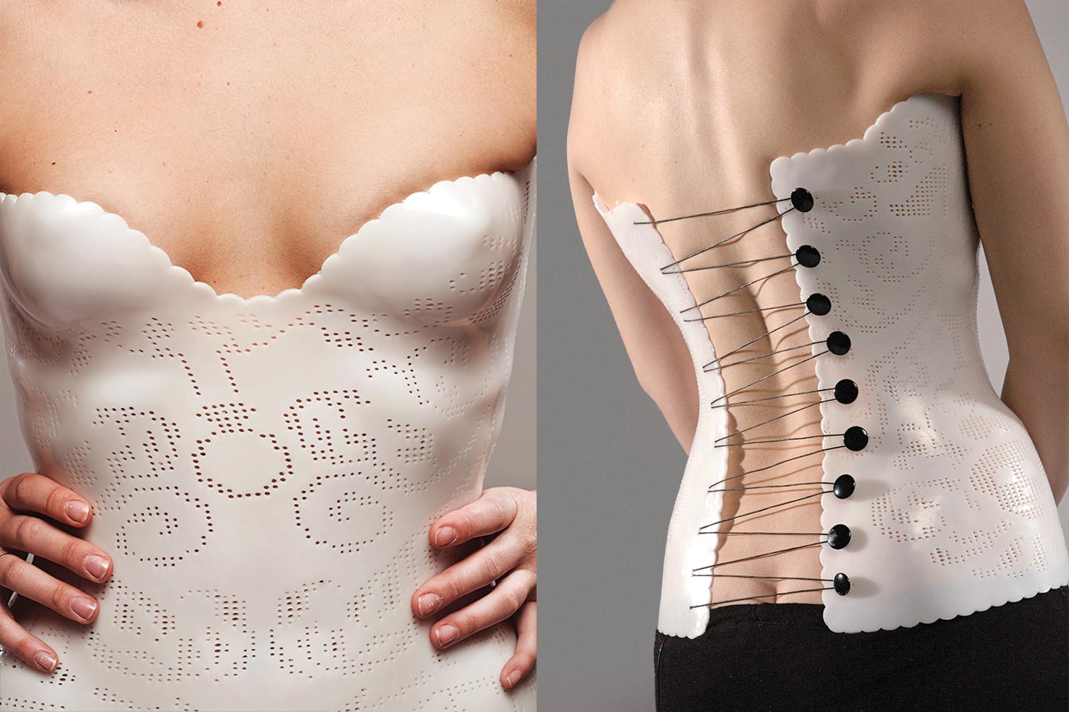 Lanzavecchia_Proaesthetics_backbrace
